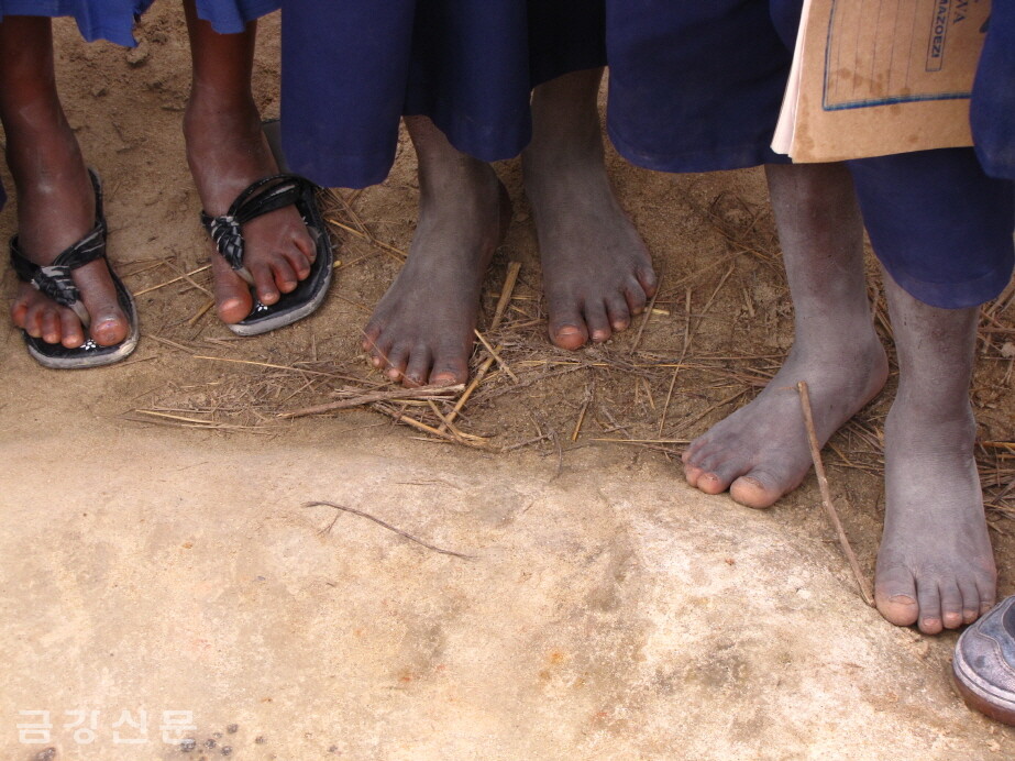 아이들은 흙에 사는 기생충이 발에 파고들어 코끼리 발처럼 붓는 ‘상피병’의 위험에 노출돼 있다.